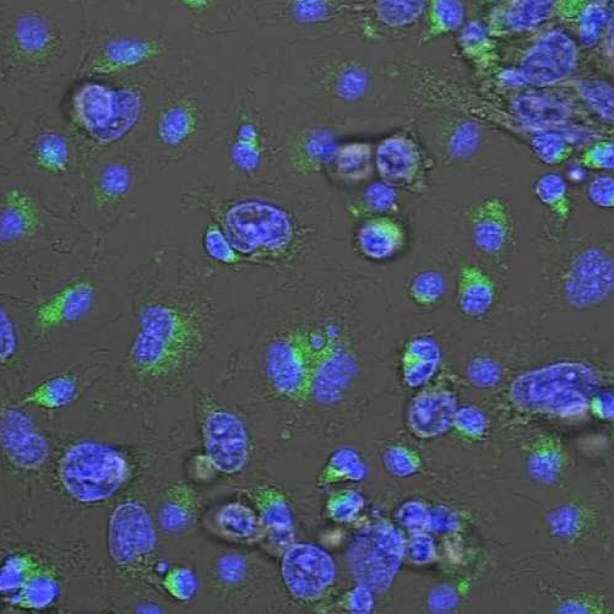 Posible nuevo f&aacute;rmaco para reducir sustancialmente la met&aacute;stasis en el c&aacute;ncer de mama